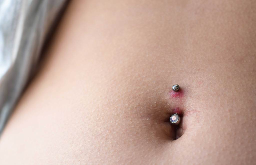 Nahaufnahme eines entz&uuml;ndeten Bauchnabelpiercings 
