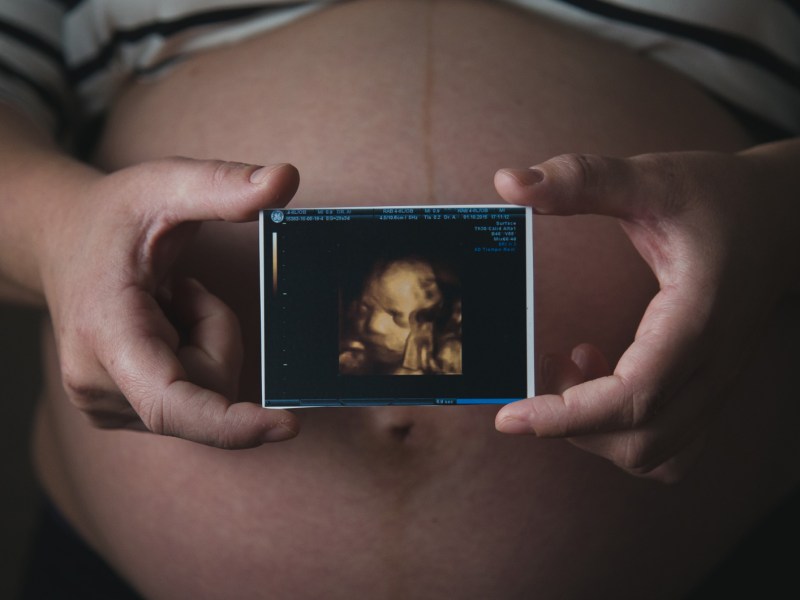 Eine schwangere Frau hält ein 3-D-Ultraschallbild vor ihren Bauch.
