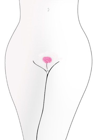 Intimfrisur: Europ&auml;ische Art