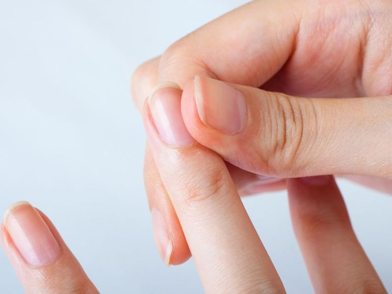 Nagelverf&auml;rbungen k&ouml;nnen durch &auml;u&szlig;ere Einflusse oder Krankheiten ausgel&ouml;st werden.