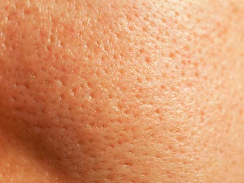 Glatte Haut trotz gro&szlig;er Poren &ndash; mit diesen Make-up-Hacks klappt&rsquo;s.