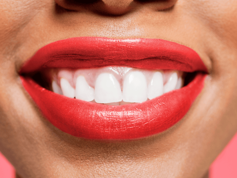 Lachender Mund mit roten Lippen